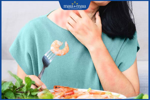 Danh sách các loại dị ứng thường gặp và biện pháp xử lý 2 ăn tôm bị dị ứng