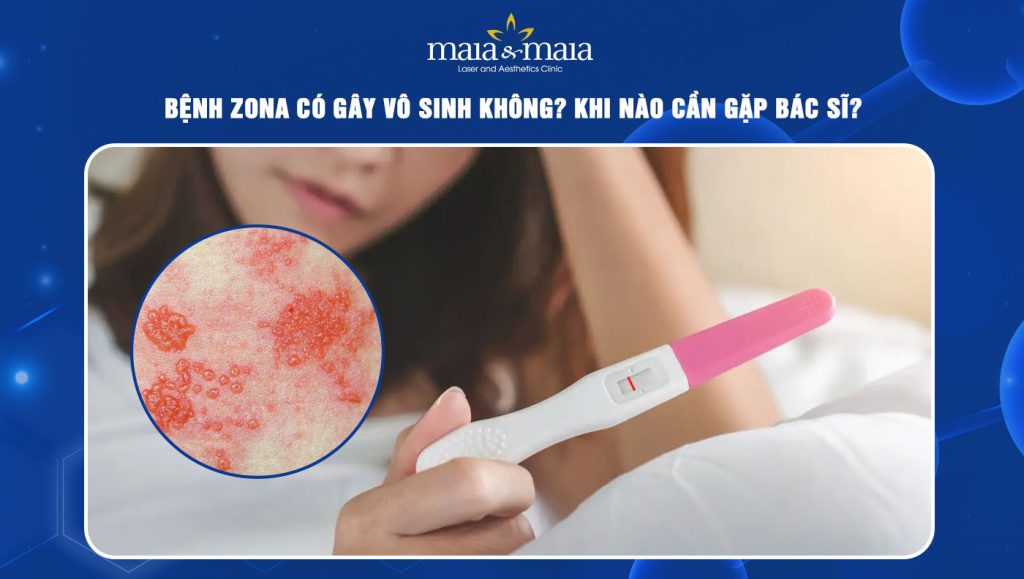 Bệnh zona có gây vô sinh không