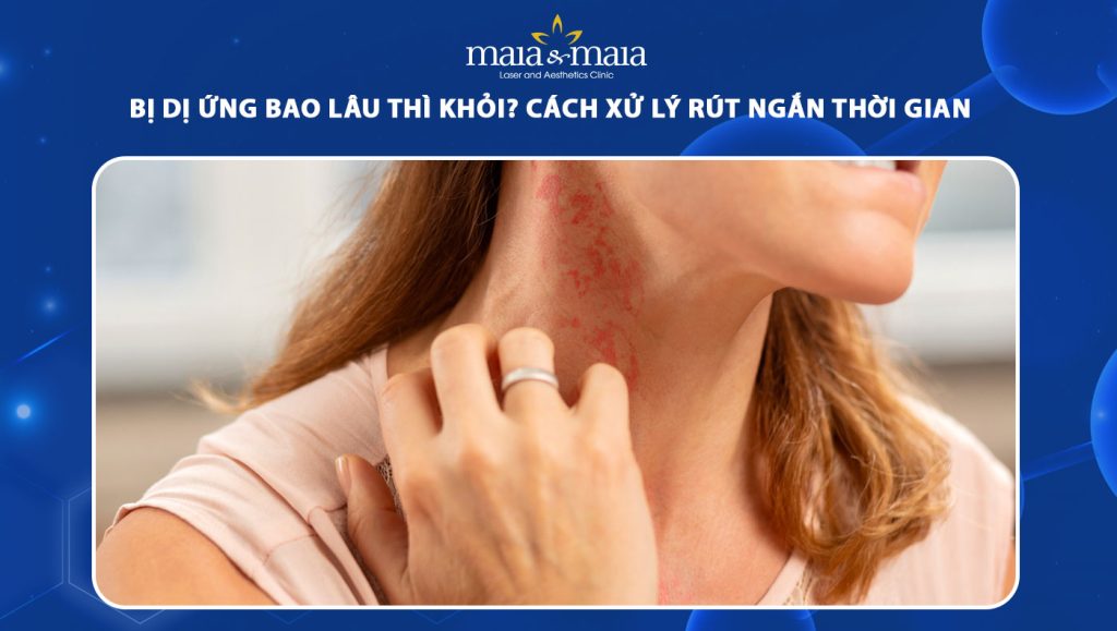 bị dị ứng bao lâu thì khỏi