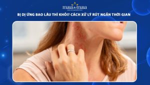 bị dị ứng bao lâu thì khỏi