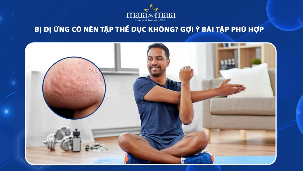 bị dị ứng có nên tập thể dục không