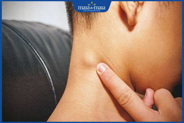 bị sưng hạch bạch huyết