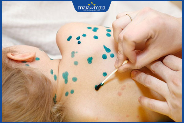 bôi dung dịch xanh methylen đúng cách