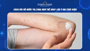cách bôi hồ nước trị zona