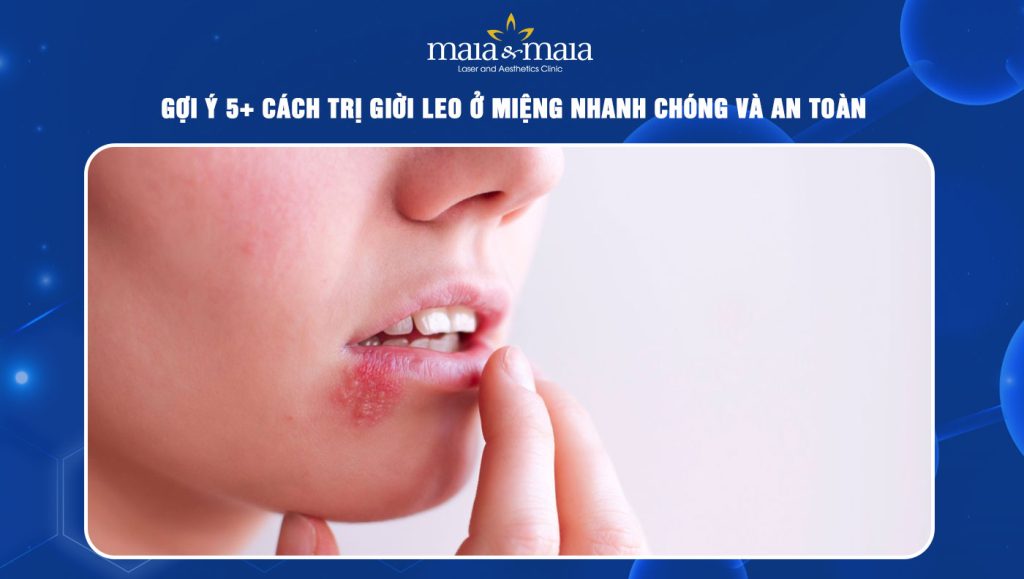 cách trị giời leo ở miệng
