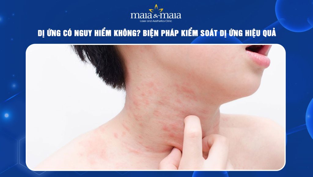 Dị ứng có nguy hiểm không? Biện pháp kiểm soát dị ứng 1 Dị ứng có nguy hiểm không