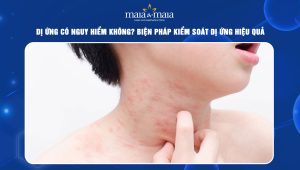 Dị ứng có nguy hiểm không