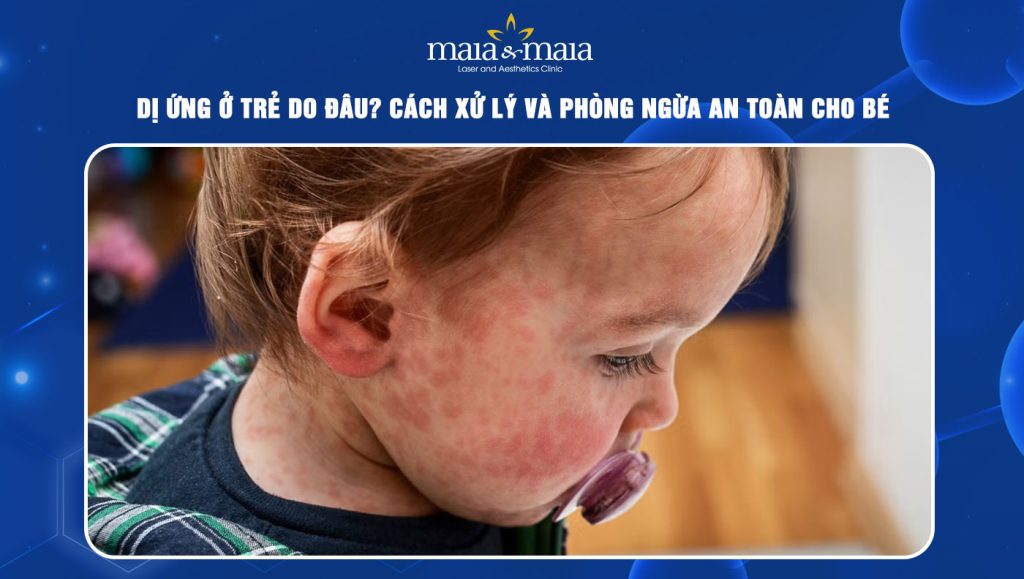 Dị ứng ở trẻ do đâu? Cách xử lý và phòng ngừa an toàn cho bé 1 dị ứng ở trẻ