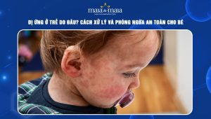 dị ứng ở trẻ