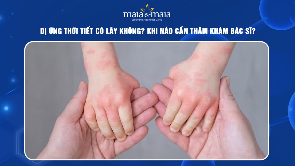 dị ứng thời tiết có lây không