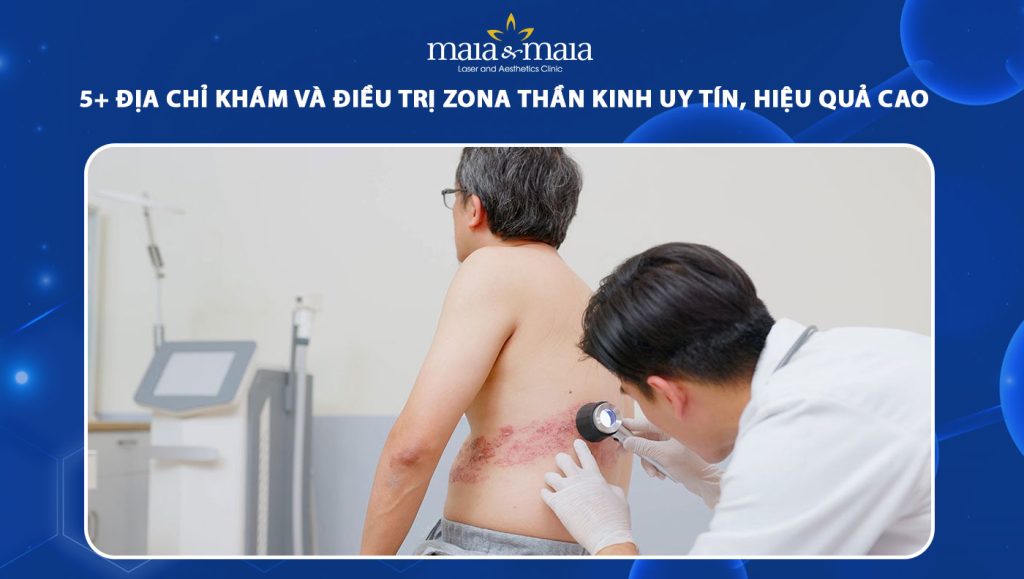 5 địa chỉ khám và điều trị zona thần kinh uy tín, hiệu quả 1 địa chỉ khám và điều trị zona thần kinh