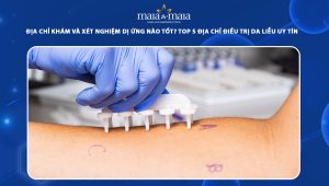 địa chỉ khám và xét nghiệm dị ứng