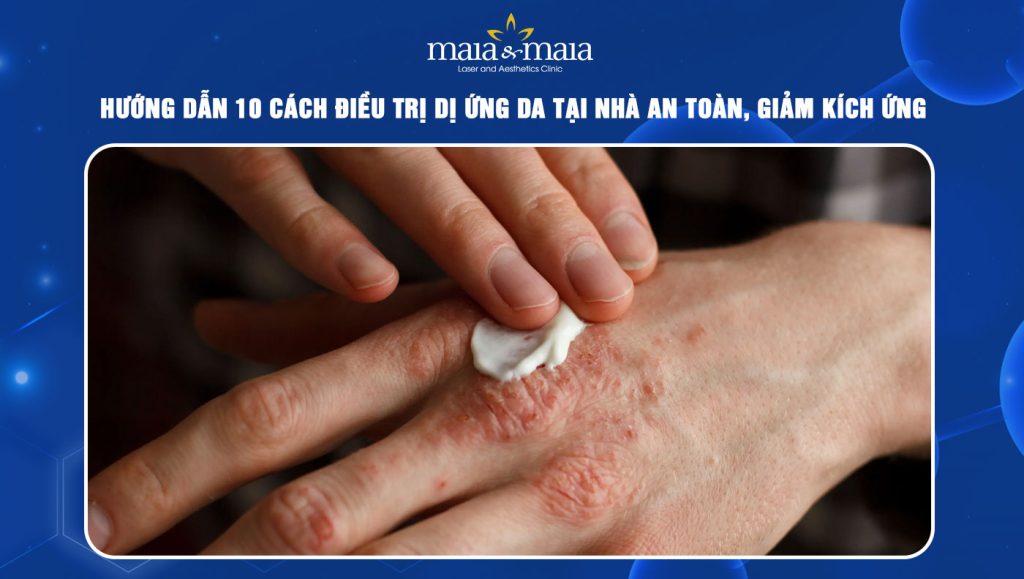 Hướng dẫn 10 cách điều trị dị ứng da tại nhà an toàn 1 điều trị dị ứng da tại nhà