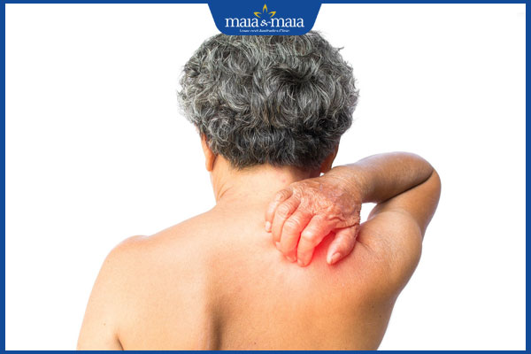 giai đoạn trước phát ban