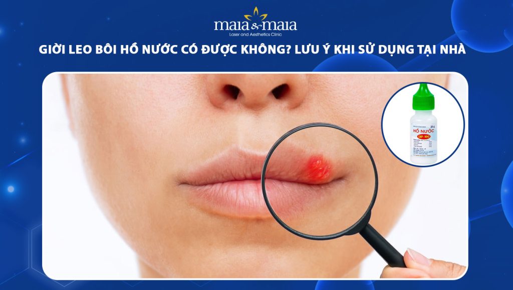 giời leo bôi hồ nước