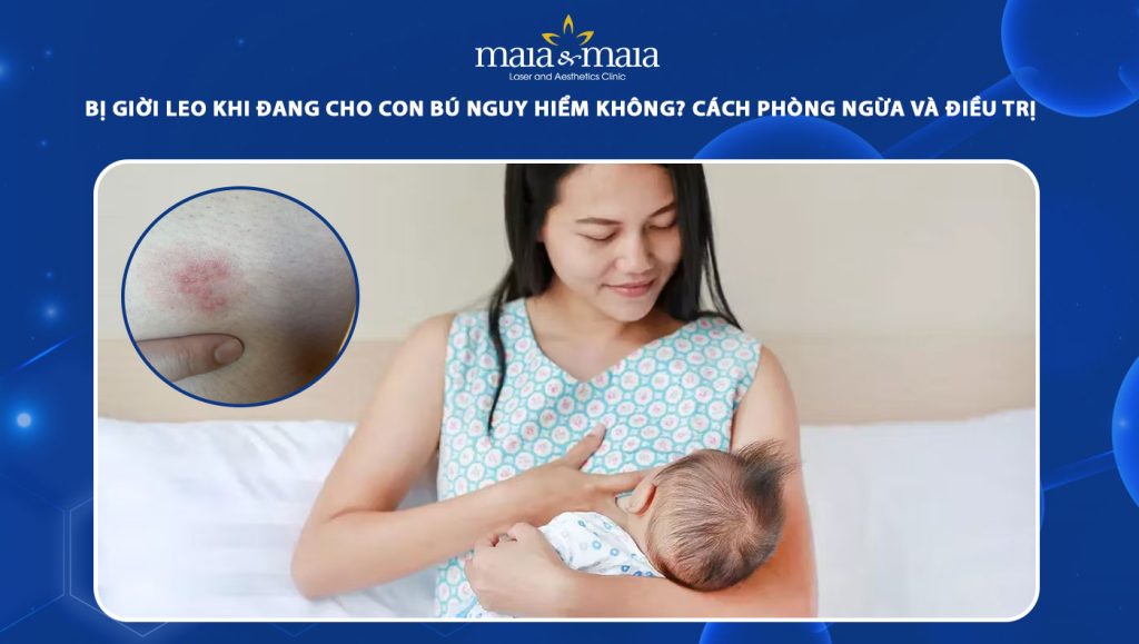 giời leo khi đang cho con bú