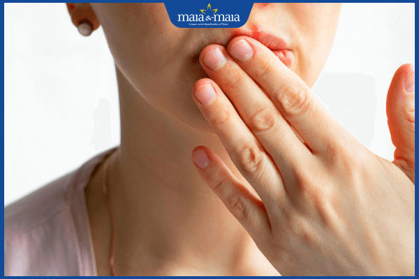 kiêng khem khi bị giời leo