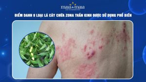 lá cây chữa zona thần kinh