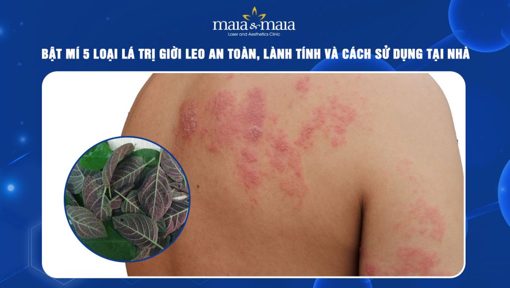 lá trị giời leo