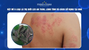 lá trị giời leo