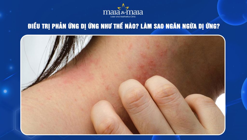 phản ứng dị ứng