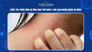 phản ứng dị ứng