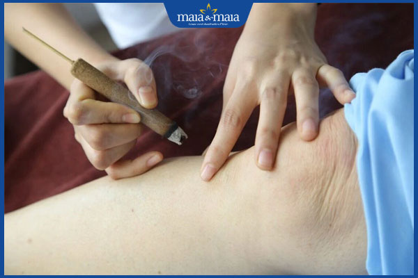 Tổng hợp 5 cách trị zona thần kinh bằng Đông y và các lưu ý 4 phương pháp cứu ngải