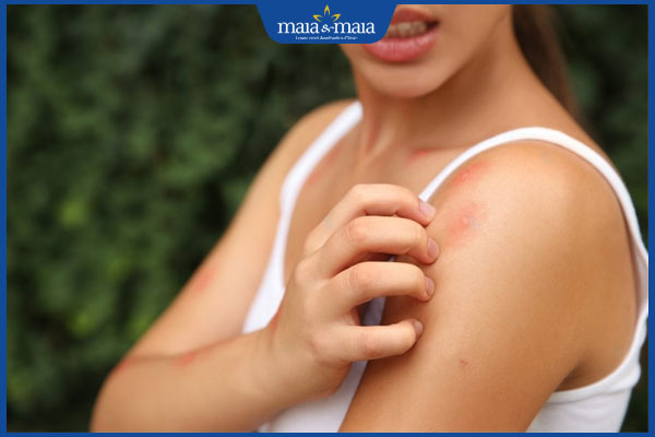 Nhận biết triệu chứng dị ứng thuốc và 5 nhóm thuốc cần chú ý 6 thời gian khỏi dị ứng