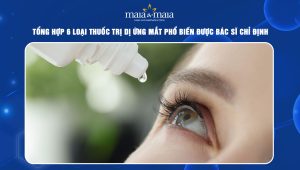 Thuốc trị dị ứng mắt