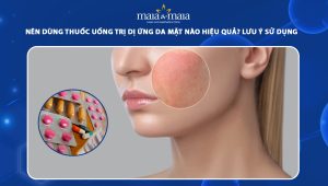 thuốc uống trị dị ứng da mặt