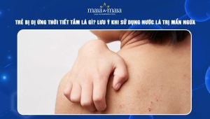 Trẻ bị dị ứng thời tiết tắm lá gì