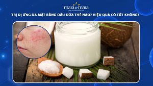 trị dị ứng da mặt bằng dầu dừa
