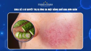 trị dị ứng da mặt bằng khổ qua