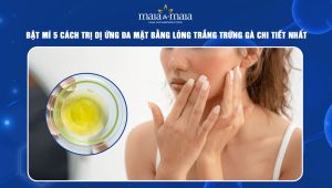 trị dị ứng da mặt bằng lòng trắng trứng gà
