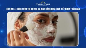 trị dị ứng da mặt bằng sữa chua