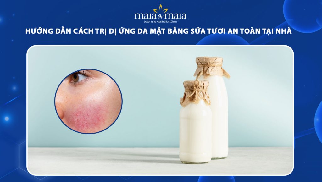 trị dị ứng da mặt bằng sữa tươi