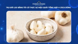 trị giời leo bằng tỏi