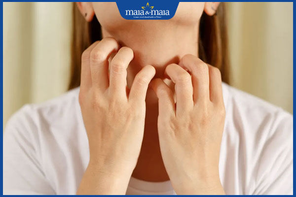 triệu chứng dị ứng thức ăn