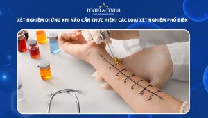 xét nghiệm dị ứng