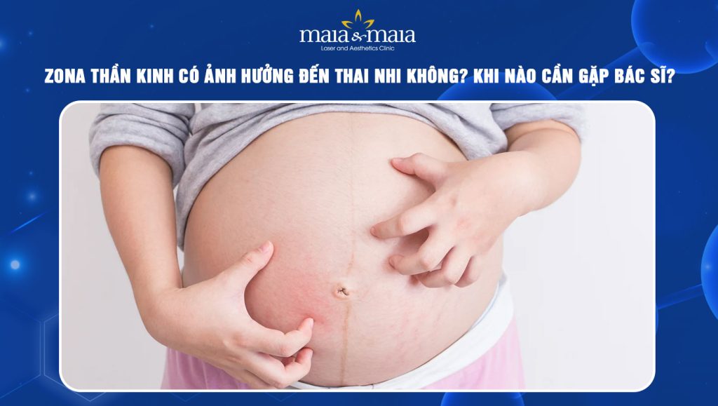 zona thần kinh có ảnh hưởng đến thai nhi không