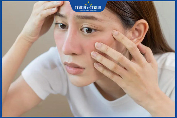 ảnh hưởng dị ứng mỹ phẩm