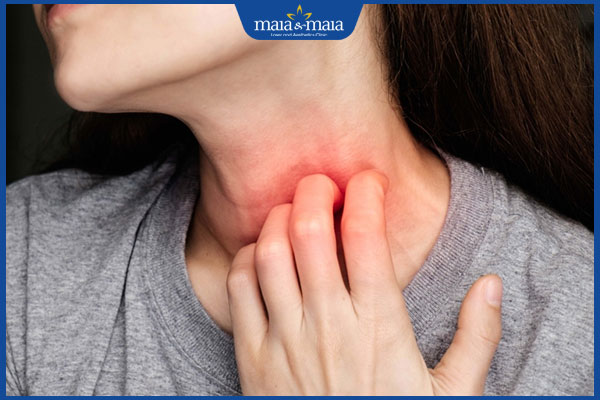 biểu hiện dị ứng hải sản