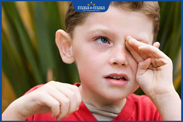 biểu hiện trẻ dị ứng