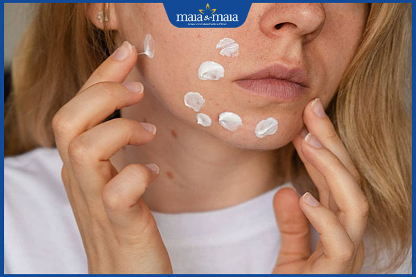 bôi kem dị ứng mặt