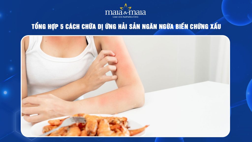 cách chữa dị ứng hải sản