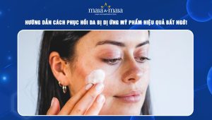 cách phục hồi da bị dị ứng mỹ phẩm