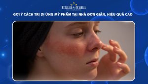 cách trị dị ứng mỹ phẩm