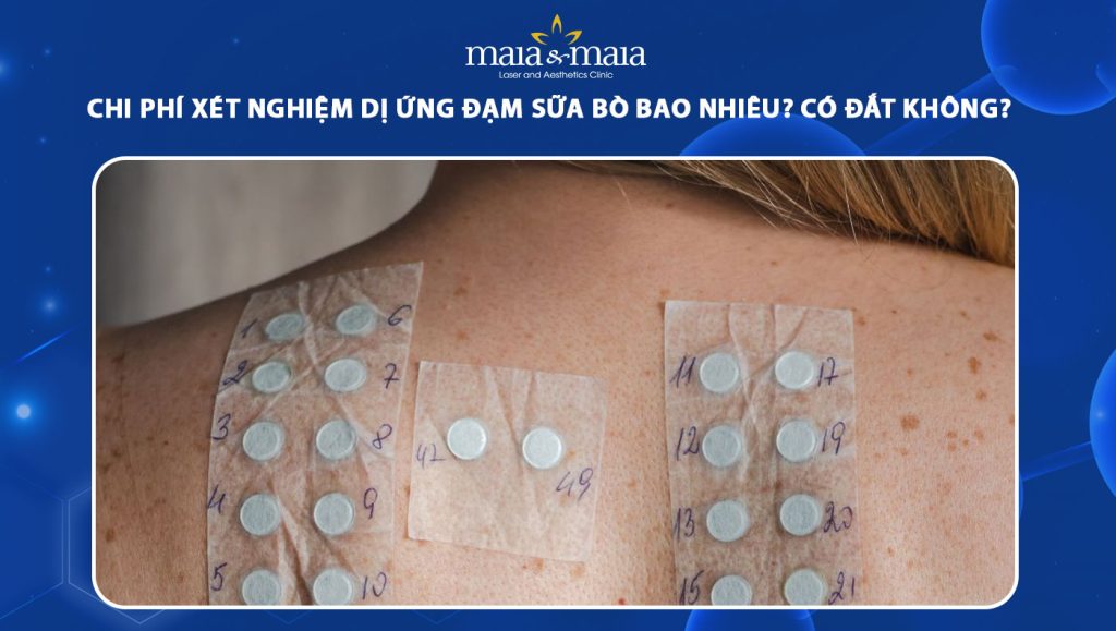 Chi phí xét nghiệm dị ứng đạm sữa bò thế nào? Có đắt không? 1 chi phí xét nghiệm dị ứng đạm sữa bò