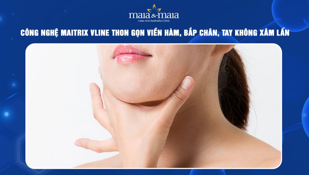 công nghệ Maitrix Vline thon gọn viền hàm