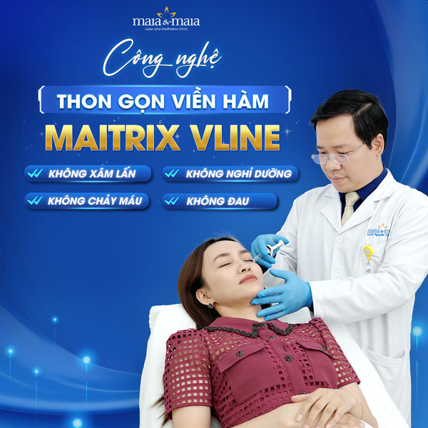công nghệ maitrix vline